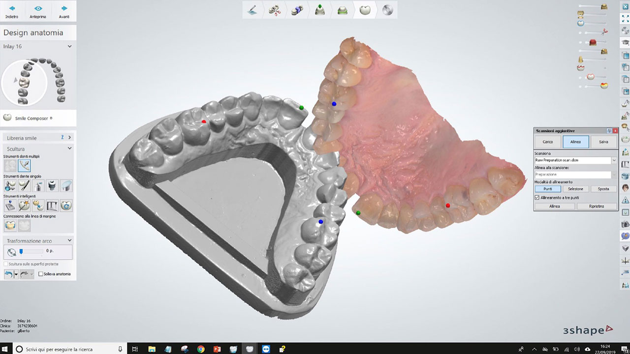 Arco facciale e articolatore analogici