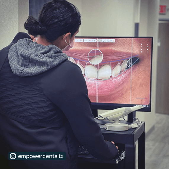 3Shape intraoral scanner in use