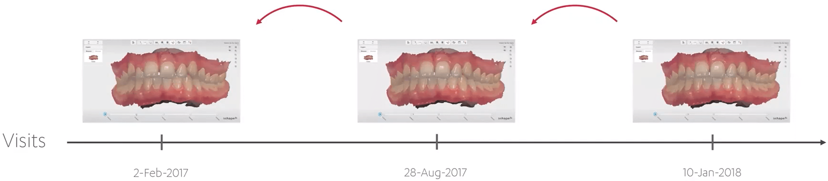 Scan each patient TRIOS patient monitoring