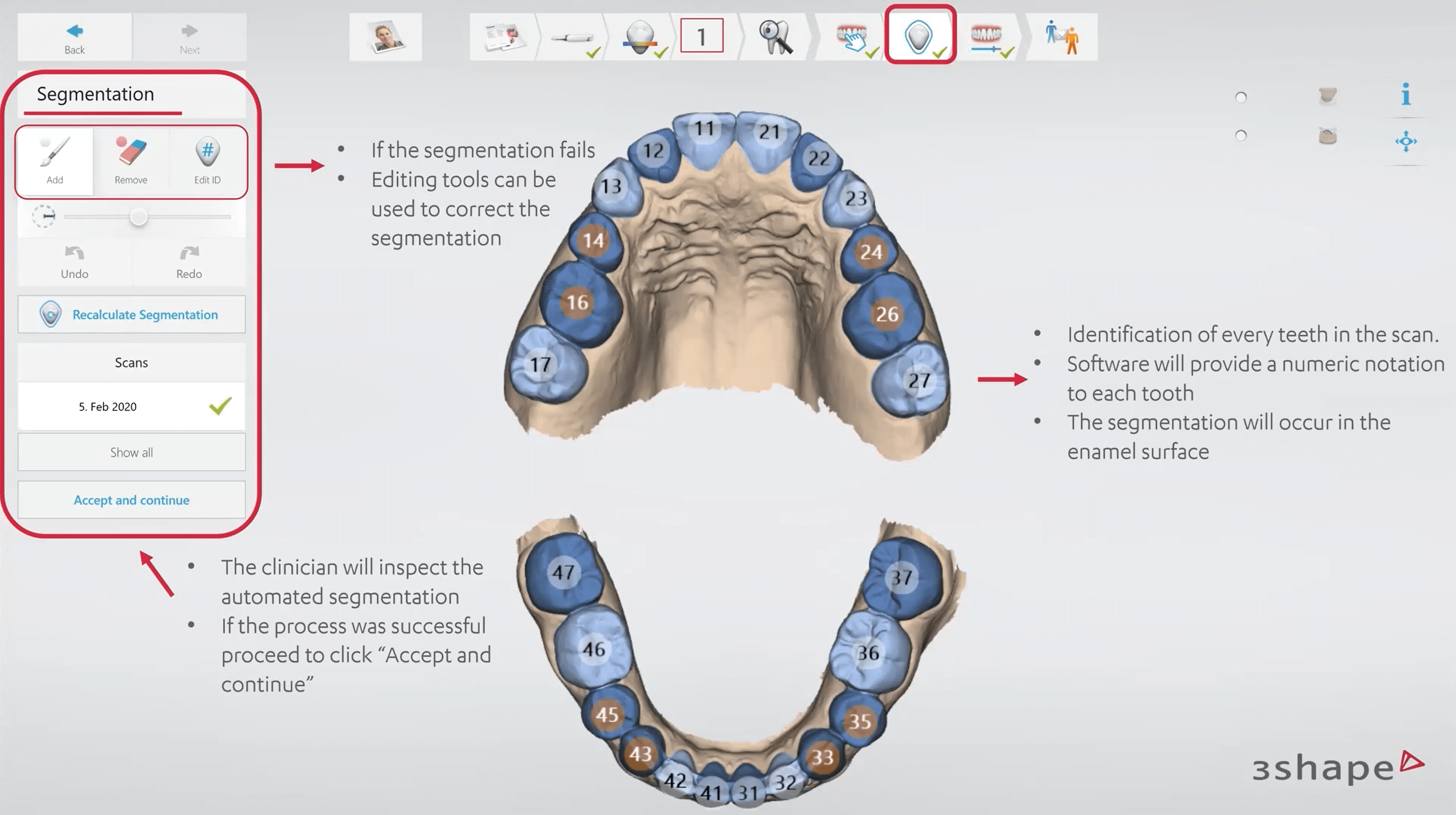 scan strategy for full arch scans