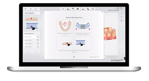 Manual Bite Alignment