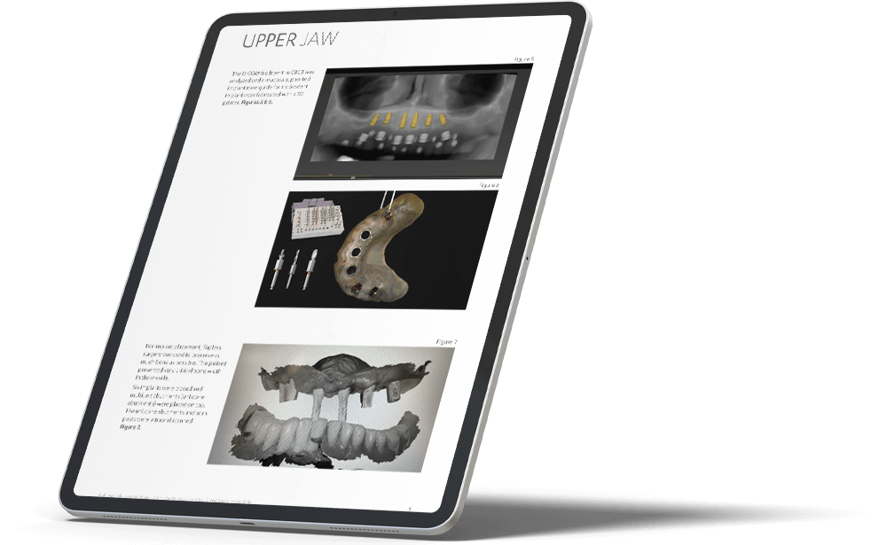full mouth restoration case study