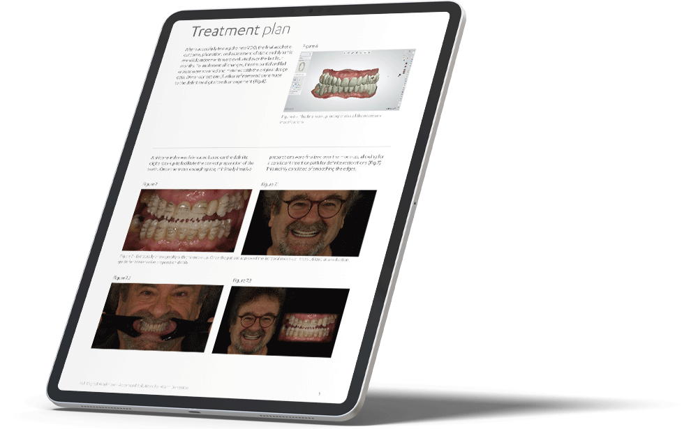 Advanced Solutions for Worn Dentition iPad