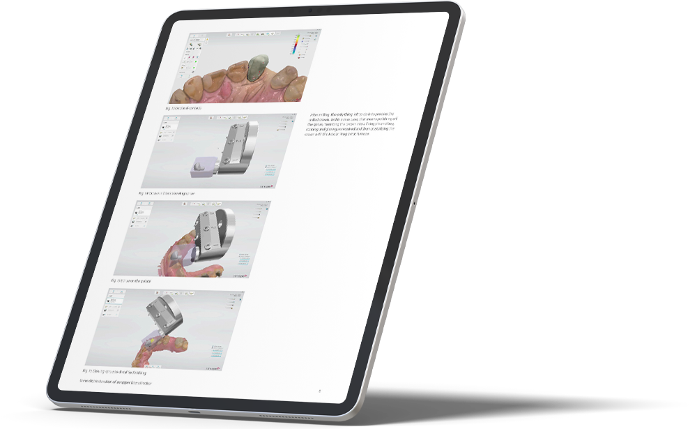 Dental System software on tablet
