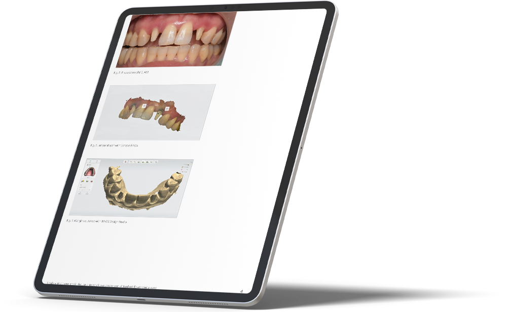 Dental System software on tablet