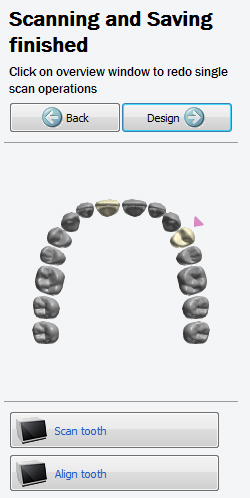 3Shape software tips august 2013