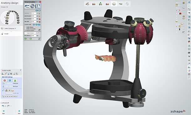 Check dynamic occlusion in the software