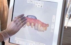Automatic Shade Measurement
