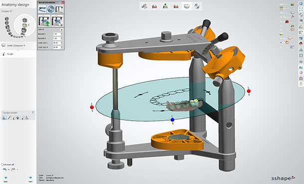 use virtual articulators