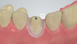 using shade measurement 10