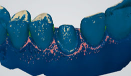using shade measurement 11