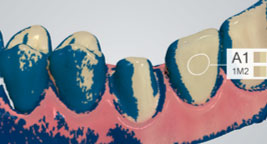 using shade measurement 15