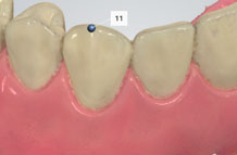 using shade measurement 19
