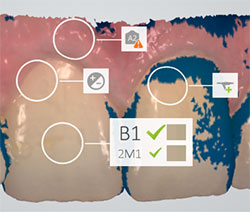 3Shape TRIOS automatically measures snades
