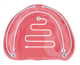edentulous intraoral scanning protocol