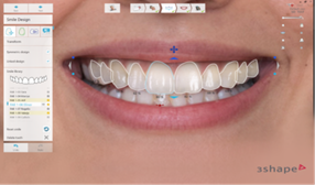 TRIOS Smile Design