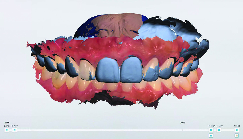 Digital dental monitoring