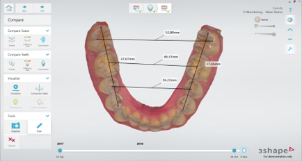 Ruler for Scan Measurements