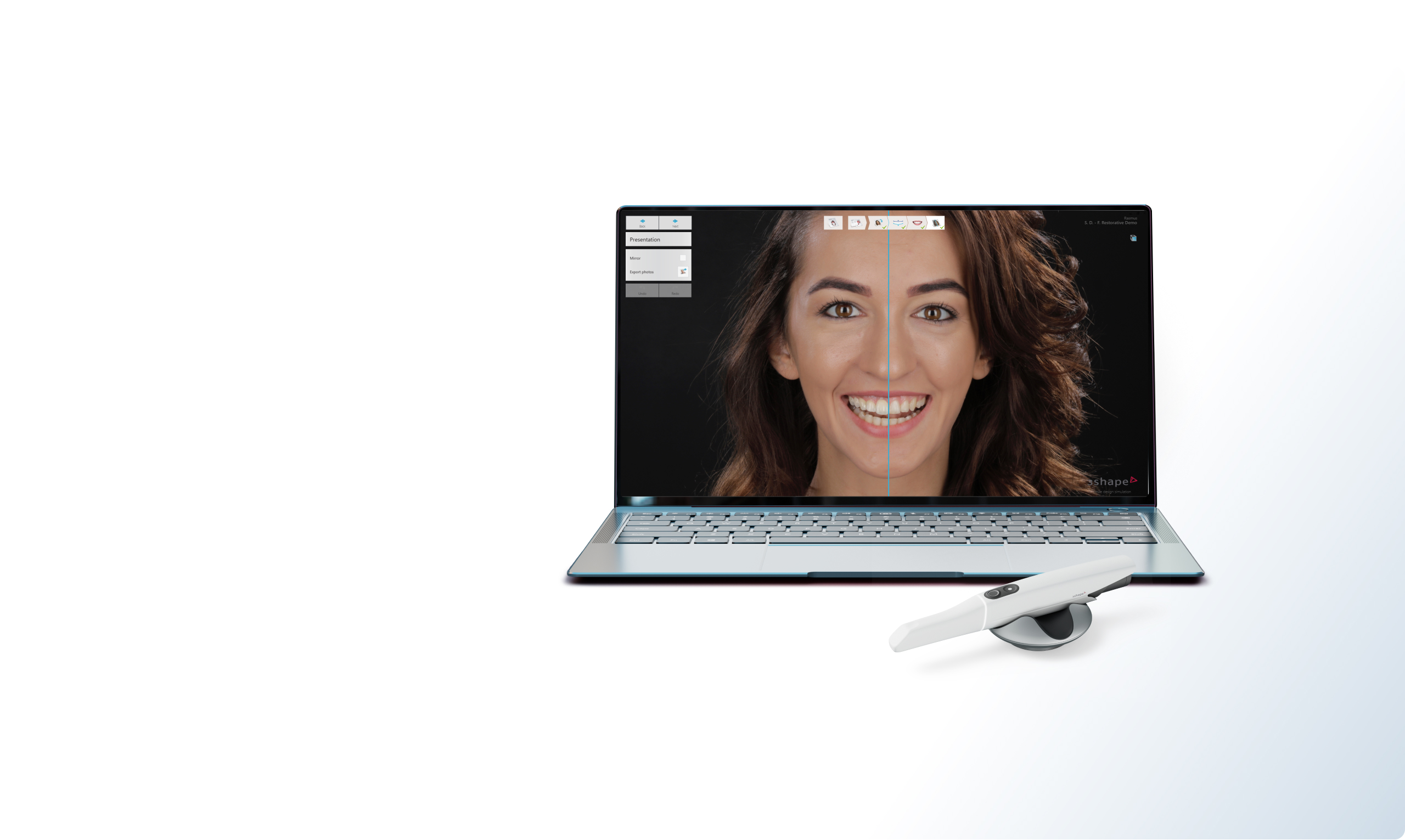 Lächeln und Leben mit TRIOS Smile Design verbessern