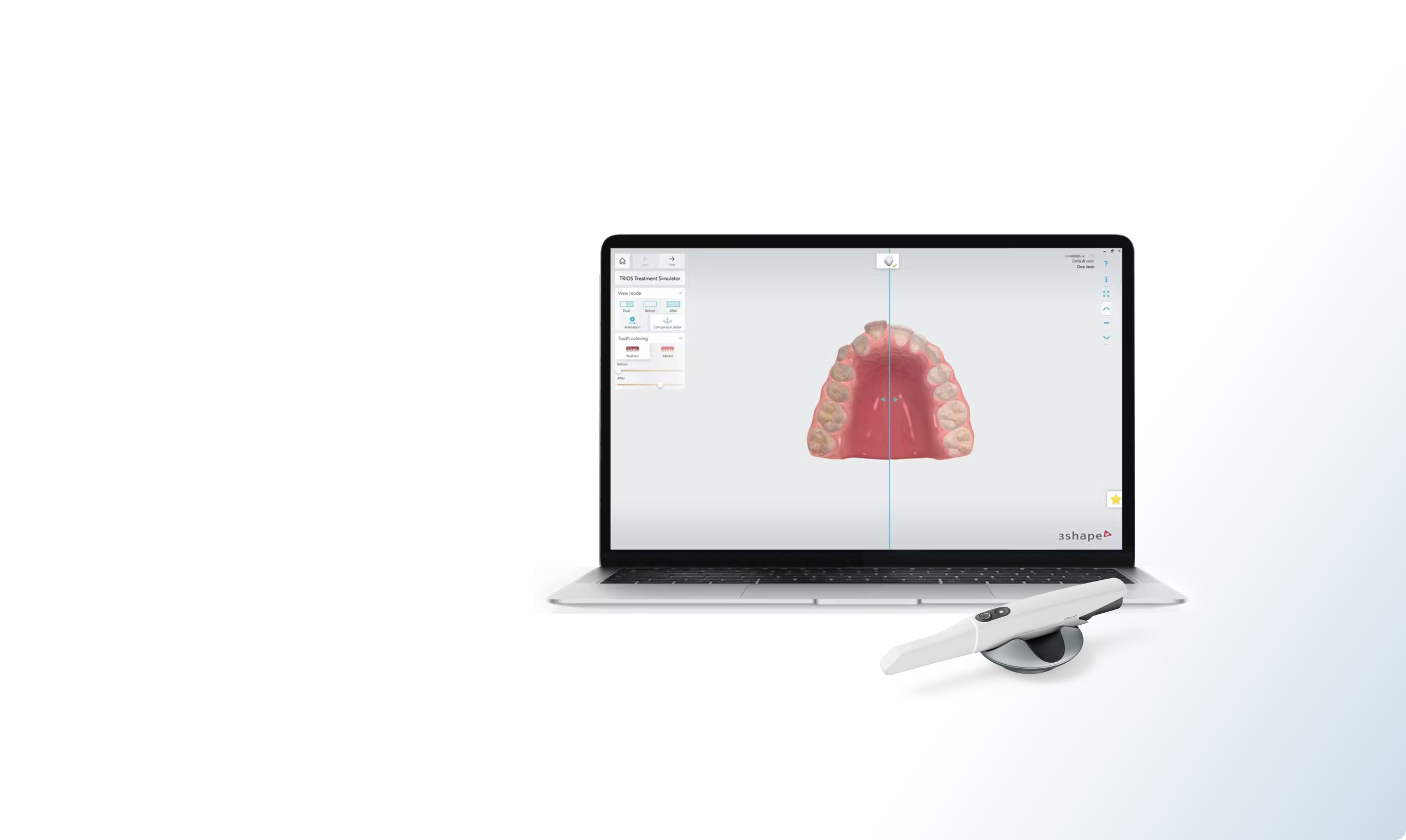 Dental System with TRIOS 5